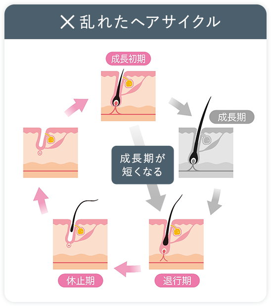 乱れたヘアサイクル